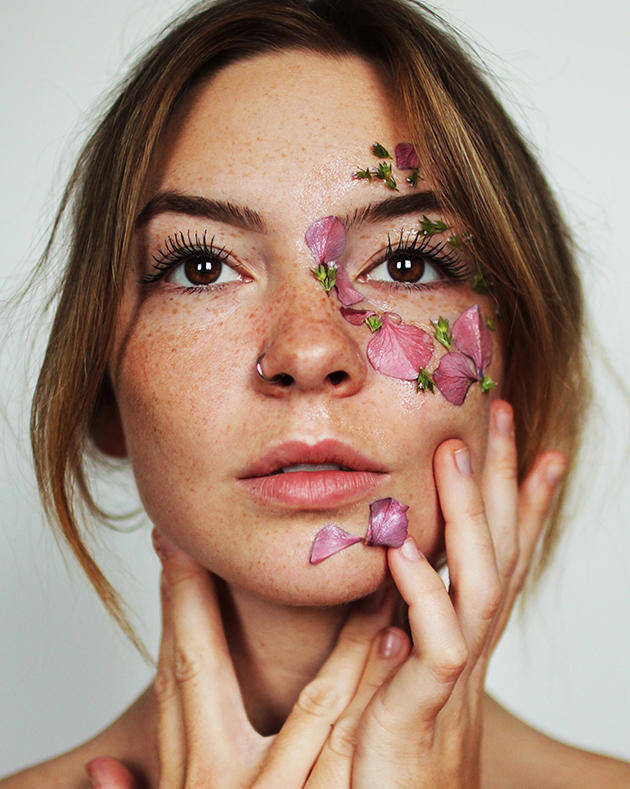 Psoriasis!! You need a Panchkarma detox. Now